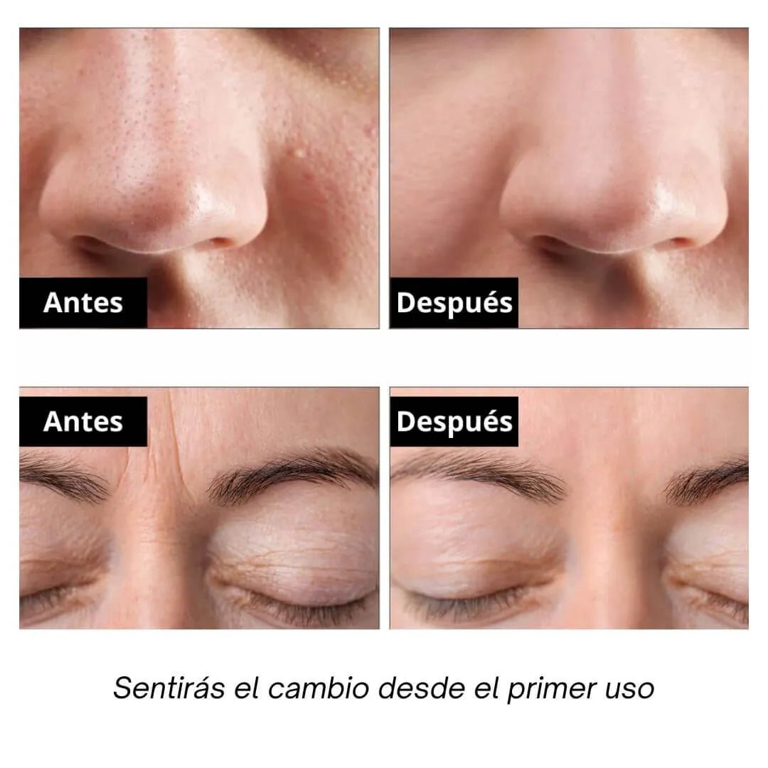 Exfoliante Facial Ultrasónico - Skin Scrubber