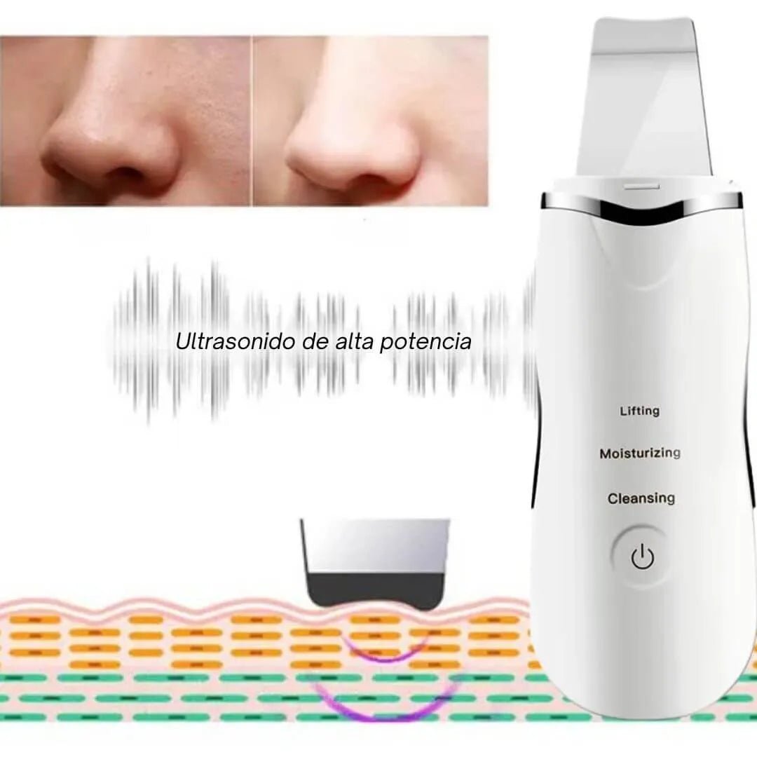 Exfoliante Facial Ultrasónico - Skin Scrubber